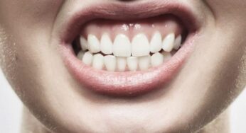 Bruxism (Menggertakkan Gigi): Mengapa Anda Perlu Peduli?